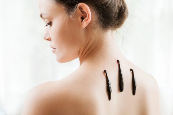 Frau mit Blutegeltherapie Frau mit Blutegeltherapie auf dem Rücken, weißer Hintergrund