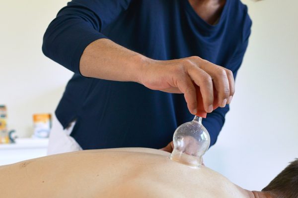 Schröpfen Schröpfen